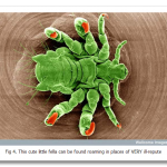 Looking-at-the-World-through-a-Microscope-PII-pubic-louse1.png