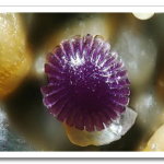 Dr.-Gary-Greenber-Microscopic-Sand-3a.png